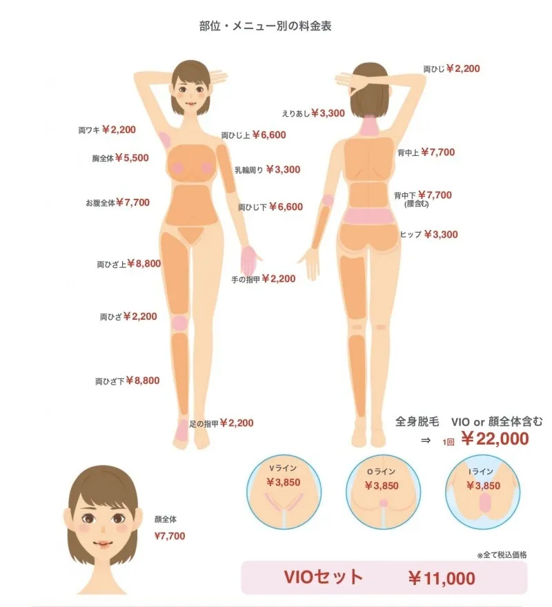 脱毛 パーツごとの価格